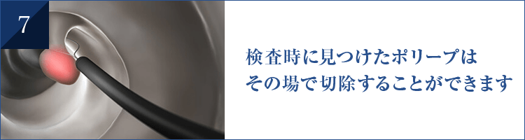 検査時に見つけたポリープは その場で切除することができます